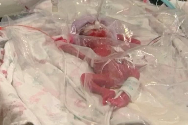 preemie, NICU, Texas