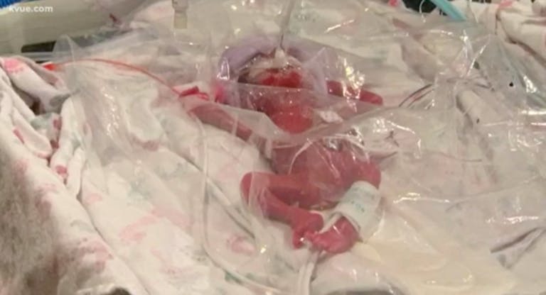 preemie, NICU, Texas