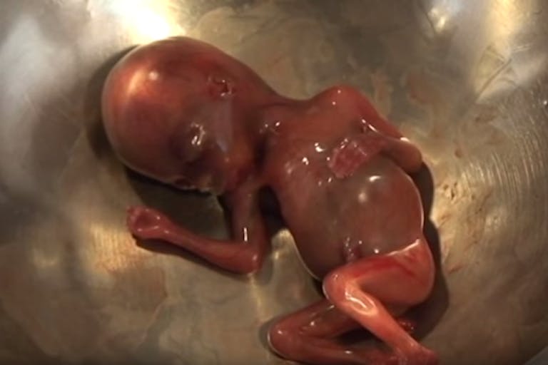 video-fetus