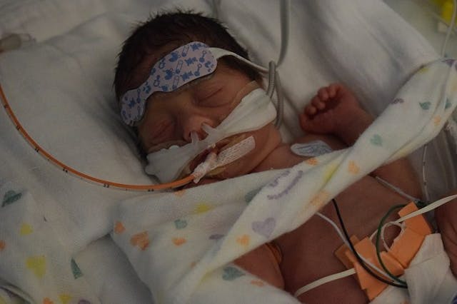 Baby Petra in the hospital after her premature birth. Photo courtesy of Staycie Kirkendall. Petra was a premature baby.