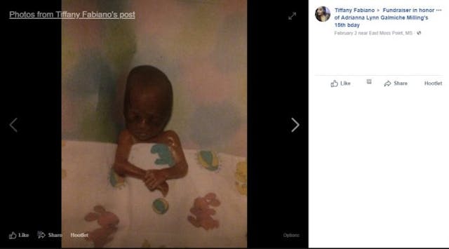 Adrianna was premature, and doctors refused to help her. Adrianna was premature, and doctors refused to help her.