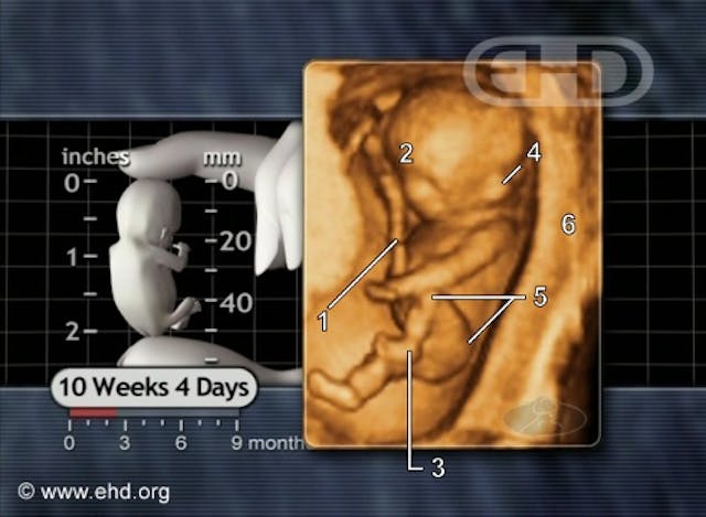 left-knee-and-hip-flexion