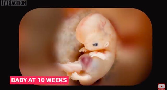 A preborn baby at 10 weeks.