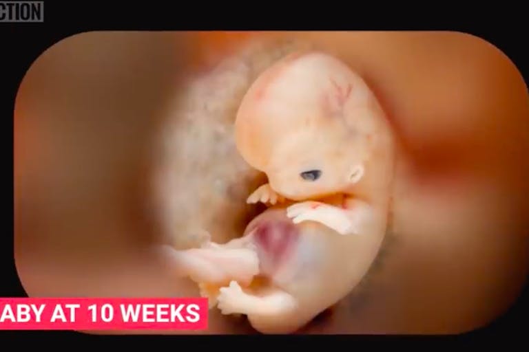 10 weeks, pro-life, exceptions, abortion pill