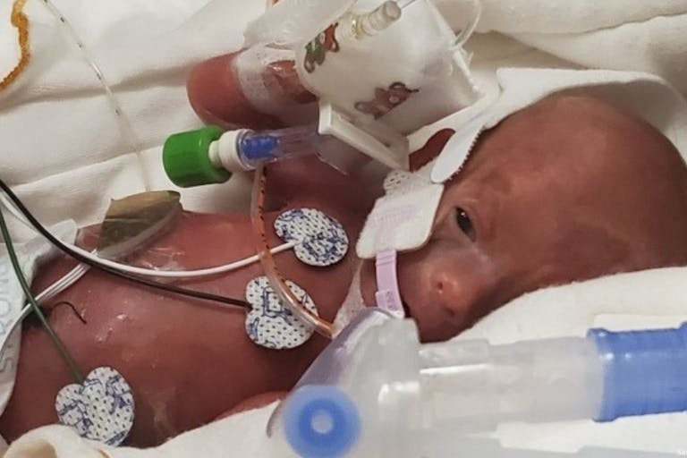 micro-preemie, premature
