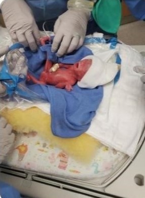 Baby Henry. Photo via GoFundMe.