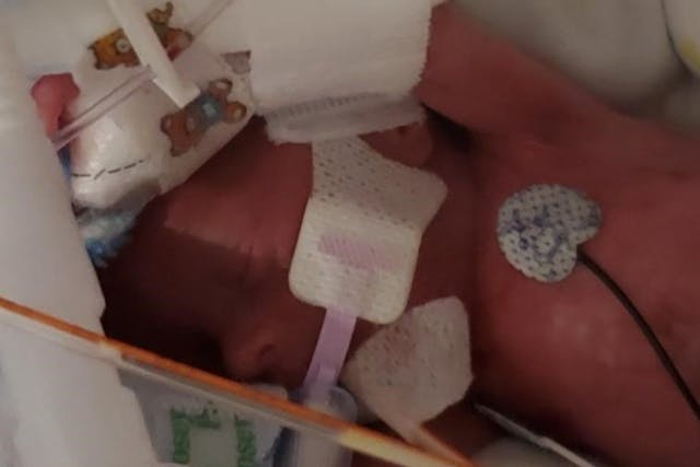 Baby Henry. Photo via Go Fund Me.