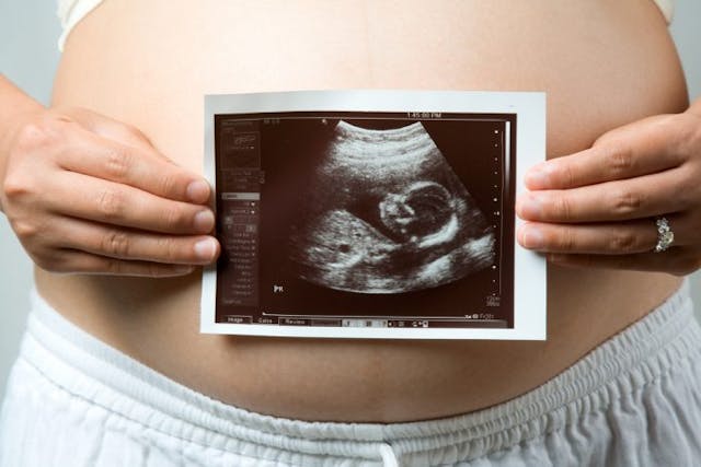 woman, women, pregnant, pregnancy, ultrasound