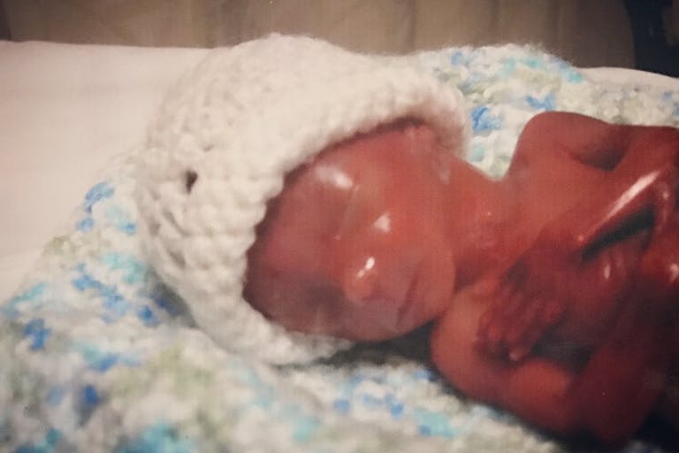 Sweet Luke Jacobs was born prematurely at 18 and a half weeks gestation and is greatly loved by his parents. Photo courtesy of Meghann Jacobs.