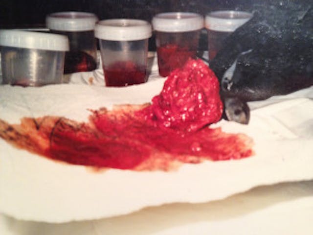 Image: Aborted babies