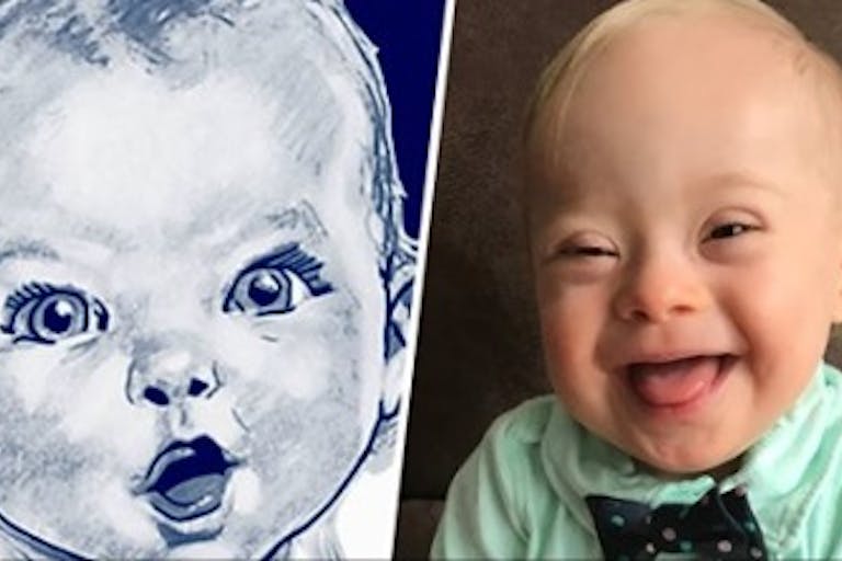 Image: Gerber selects first Baby with Down Syndrome in photo contest