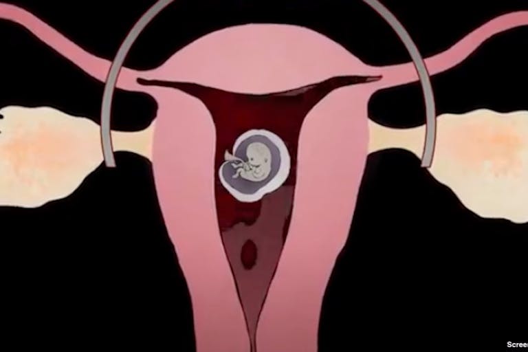 Live Action abortion pill