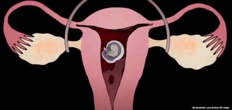 Live Action abortion pill