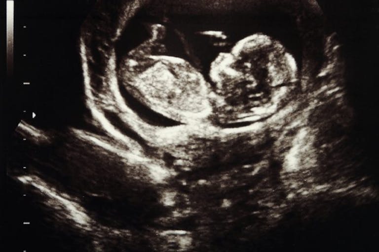Photo: Dreamstime Pregnancy centers offer free ultrasounds