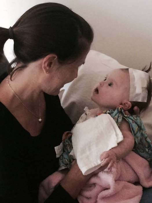 Erika and Abigail Jones after surgery.