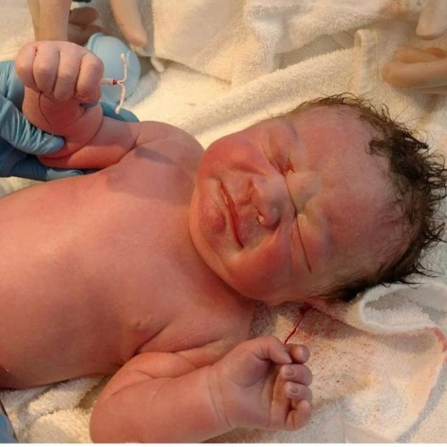 A baby holds his mother's IUD. Abortion is on the rise for women using LARCs.