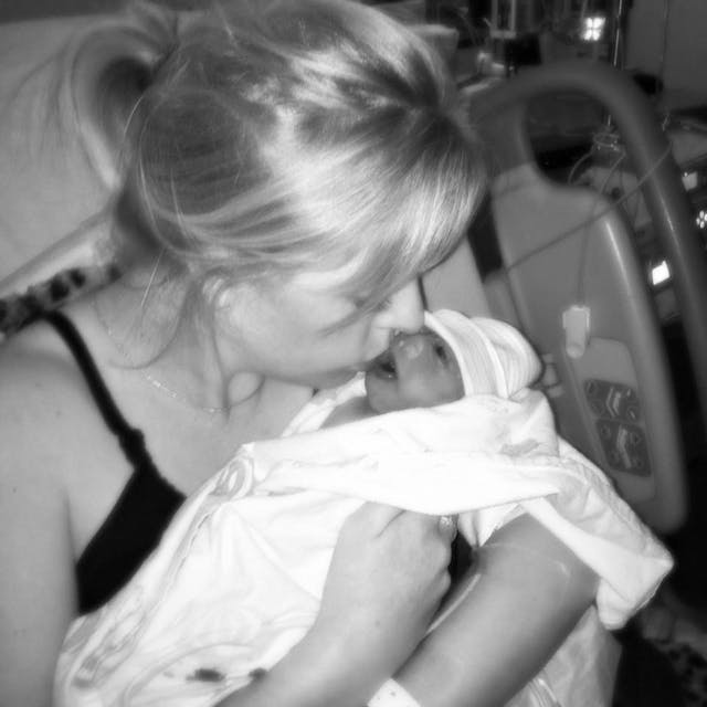 Doctor offered abortion for baby with anencephaly: ‘We can just take care of it’ image