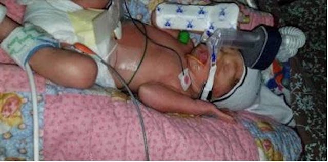 Baby Maribel is alive because her mother refused abortion despite the risks to her health