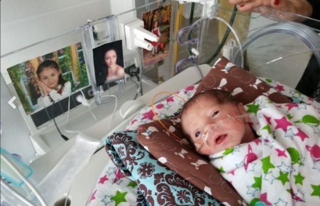 Baby Maribel is alive because her mother refused abortion Baby Maribel in the hospital.