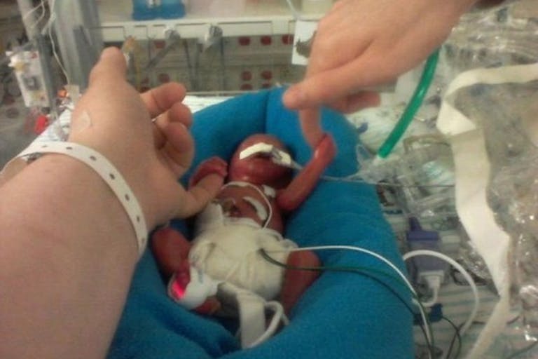 Report shows abortion industry trafficked organs of 24-week babies image