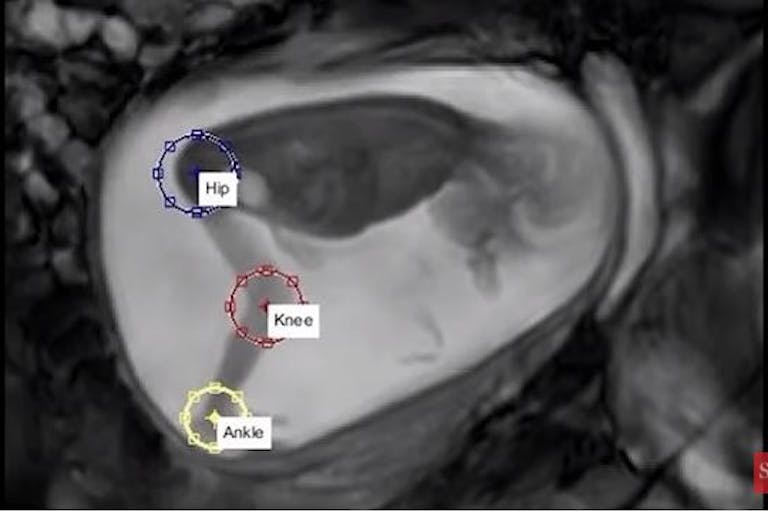 Study of preborn child kicks