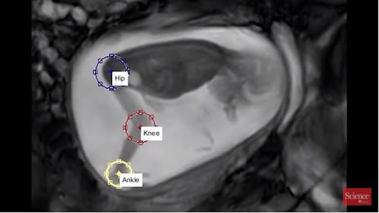 Study of preborn child kicks