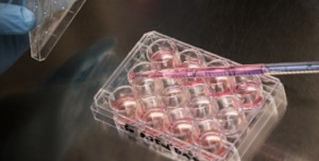 stem-cells