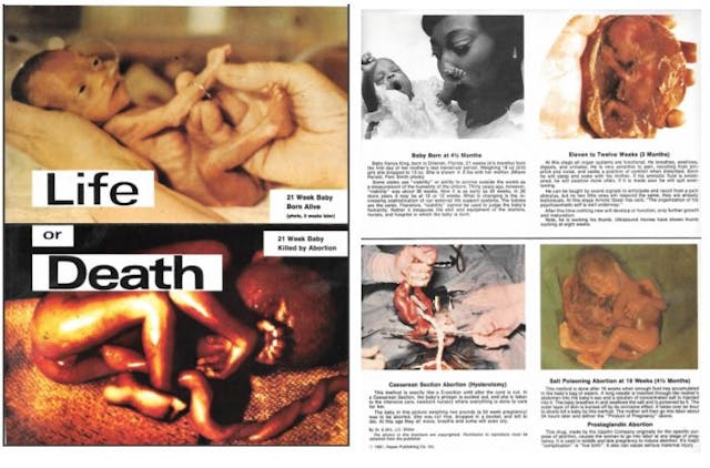 Vintage pro-life brochure “Life and Death” shows graphic abortion victim imagery. Image: Vintage pro-life brochure "Life and Death" shows graphic abortion victim imagery.
