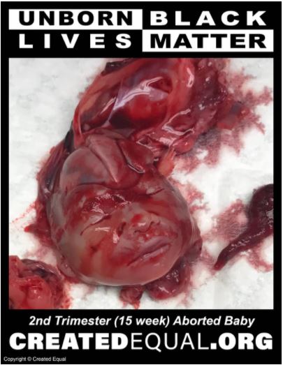 Twitter locks pro-life organization’s account for image of ‘dismembered, mutilated human’ image