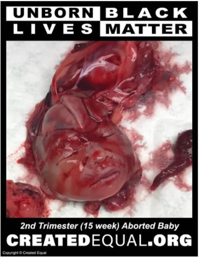 Image of graphic sign deleted by Twitter. Twitter locks pro-life organization’s account for image of ‘dismembered, mutilated human’ image