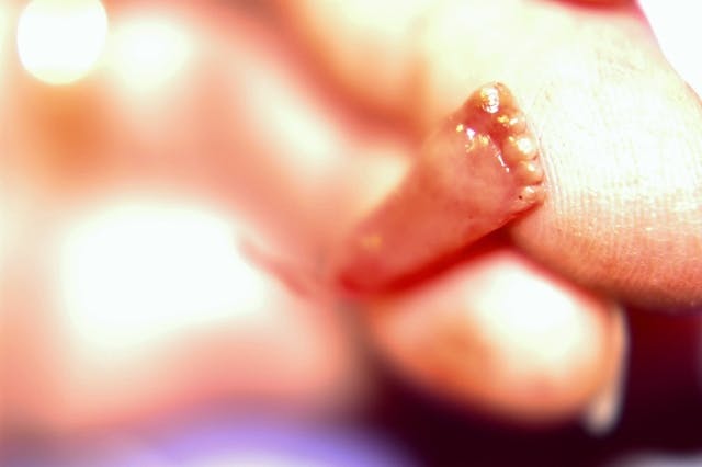 These 10 photos show the reality of late-term abortion image