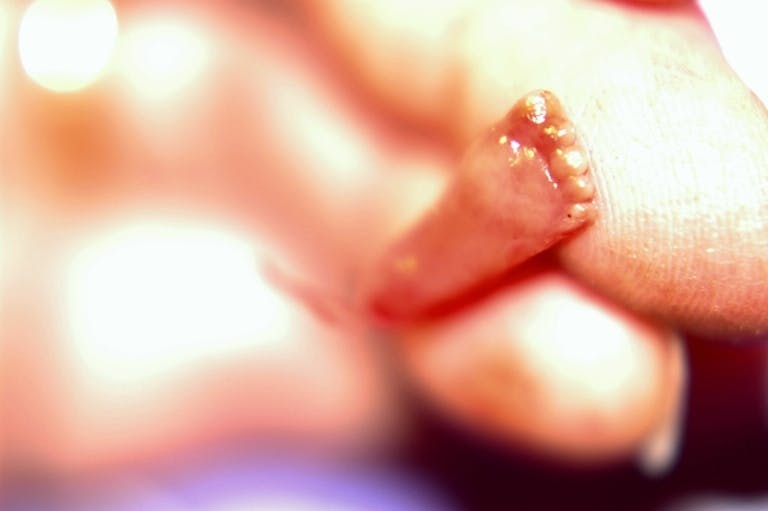 These 10 photos show the reality of late-term abortion image