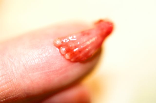 These 10 photos show the reality of late-term abortion image