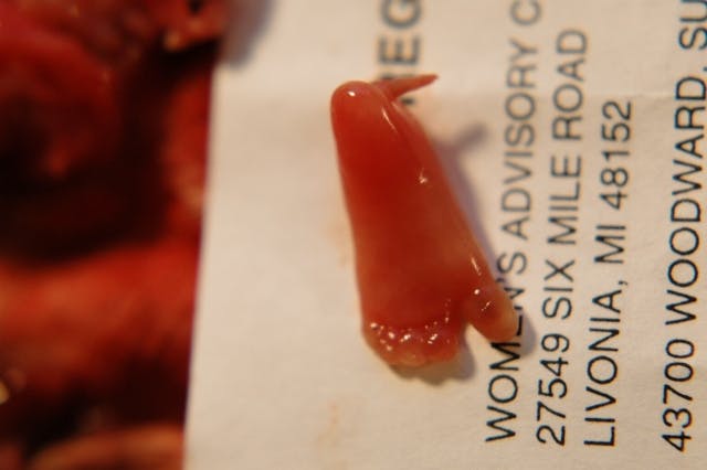 These 10 photos show the reality of late-term abortion image