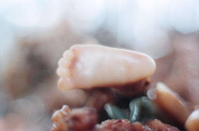 These 10 photos show the reality of late-term abortion image