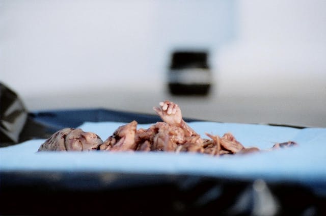 These 10 photos show the reality of late-term abortion image