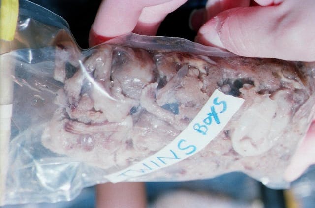 These 10 photos show the reality of late-term abortion image