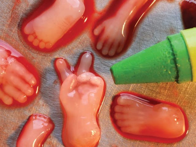 10 to 14 weeks. abortion