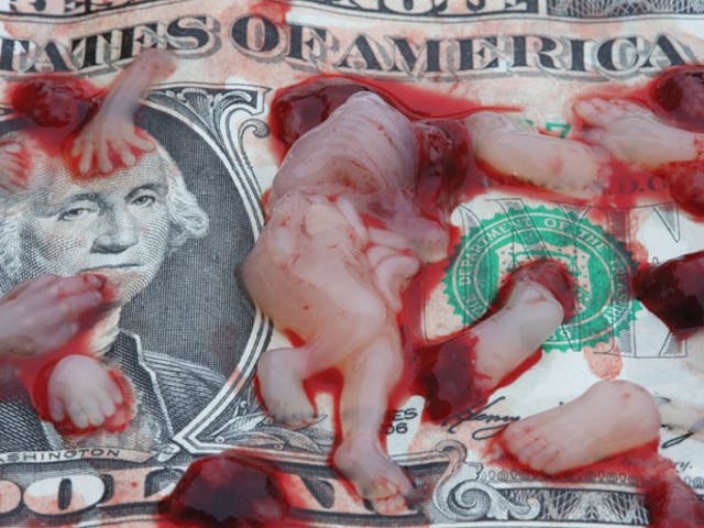 9 to 14 weeks. abortion