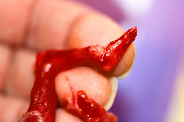 Former abortion worker: Conditions were ‘horrendous’ but inspectors asked no questions image