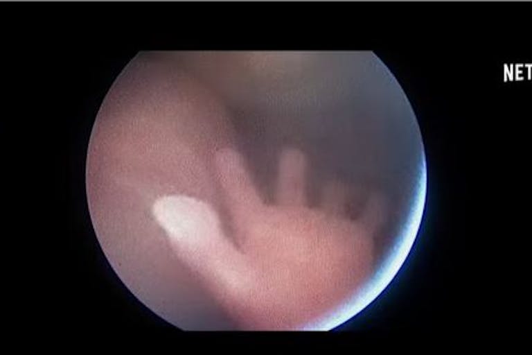 saving life before birth