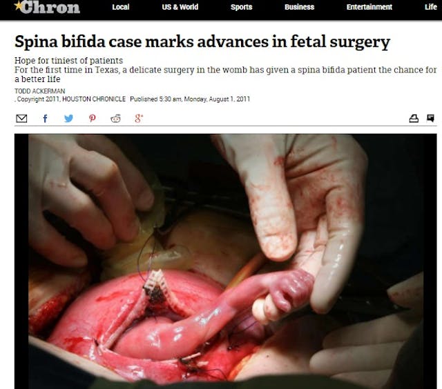 Stunning fetal surgery images offer amazing glimpse of baby in the womb image