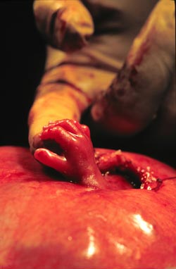 Stunning fetal surgery images offer amazing glimpse of baby in the womb image