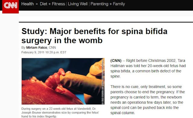 Fetal Surgery CNN Report on 20-week baby with spina bifida Stunning fetal surgery images offer amazing glimpse of baby in the womb image