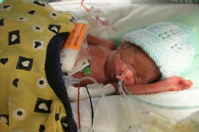 Planned Parenthood aborts babies who could survive.