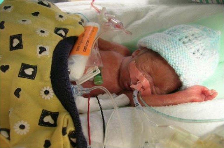 Planned Parenthood aborts babies who could survive.