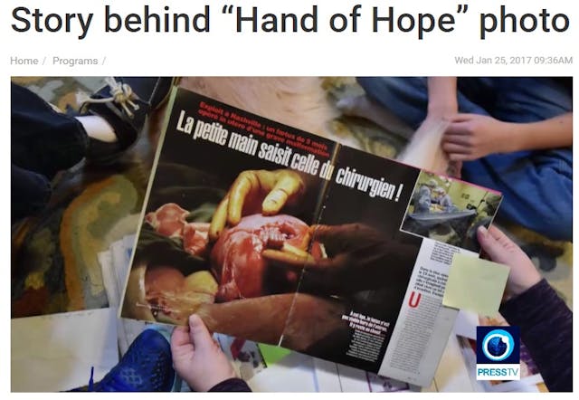 Michael Clancy Hand of Hope (image: PressTV) Stunning fetal surgery images offer amazing glimpse of baby in the womb image