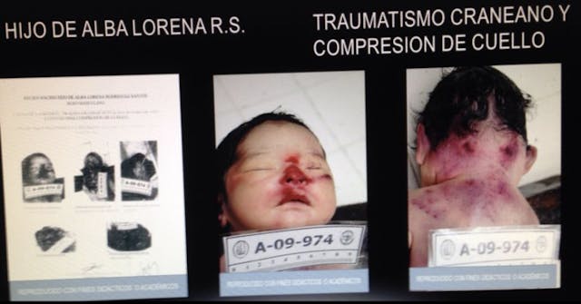 Alba Lorena Santos’ son.