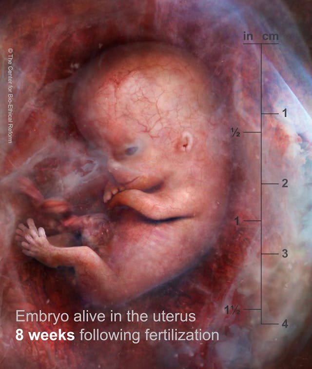 Preborn child, 8 weeks gestation Father of aborted baby: ‘I had nightmares of my child being aborted’ image