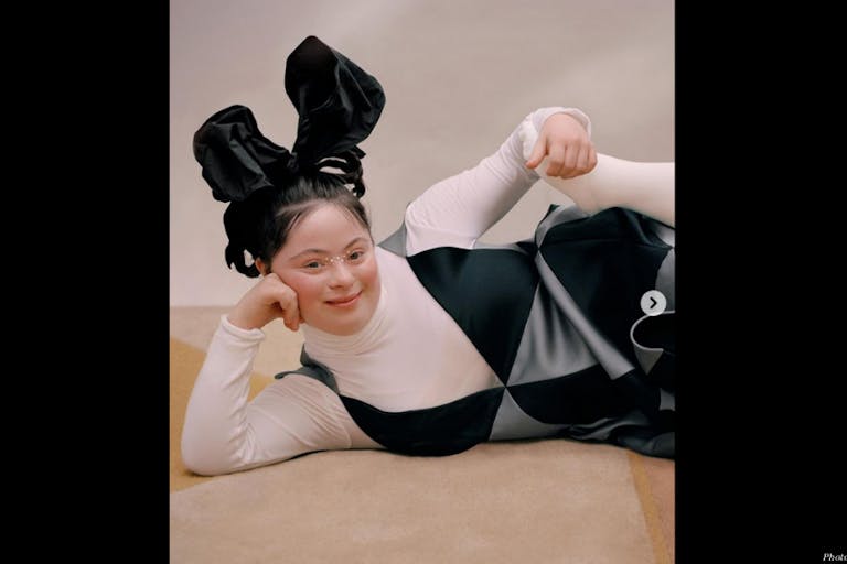 Model, Down syndrome